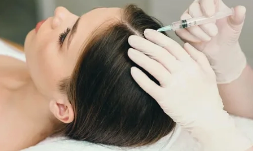 استفاده از مزایای کوکتل مزوتراپی در درمان ریزش مو