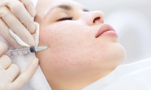 سرم پوست چیست و چرا محبوب است؟