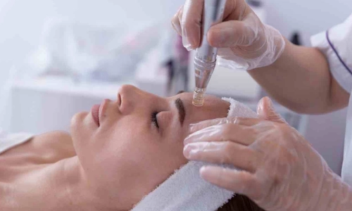 تفاوت کوکتل مزوتراپی و سرم پوست از نظر هزینه و دسترسی